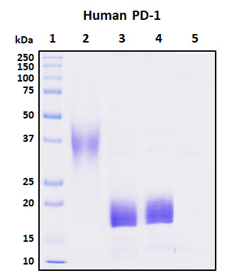 Figure 1. Deglycosylation of purified recombinant proteins. Purified proteins were untreated (Lane 2) or treated with protein deglycosylation enzymes under native (Lane 3) or reducing (Lane 4) conditions. Deglycosylation treatment resulted in a mobility shift of the protein to produce one major band at the expected size, thus indicating that the untreated recombinant protein (Lane 2) was glycosylated.<br />Lane 1: Protein standard ladder (kDa).<br />Lane 2: Untreated protein under reducing conditions.<br />Lane 3: Treated protein with deglycosylation enzymes under native conditions.<br />Lane 4: Treated protein with deglycosylation enzymes under reducing conditions.<br />Lane 5: Deglycosylation mixture only without target proteins.